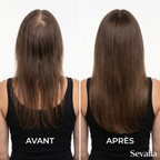 Pépins de Courge Softgels — Anti-DHT Naturel